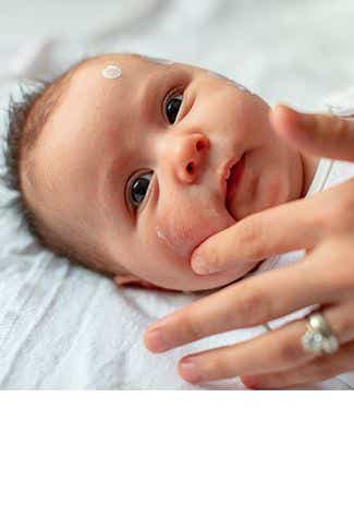 Quels sont les traitements naturels pour soigner l'eczéma de bébé ?