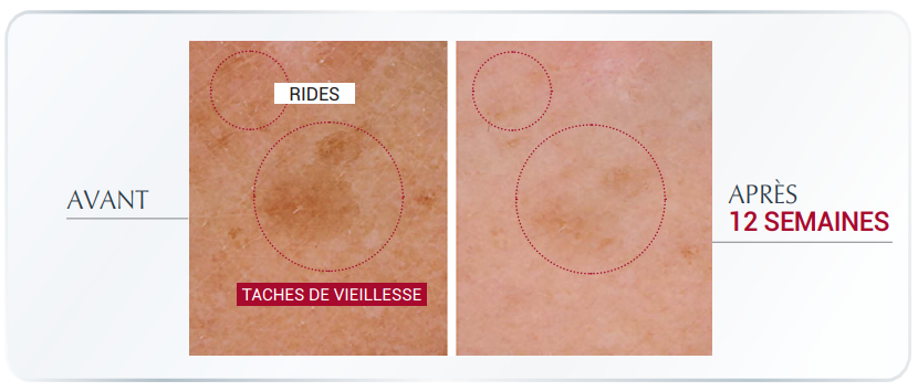 Des résultats démontrés