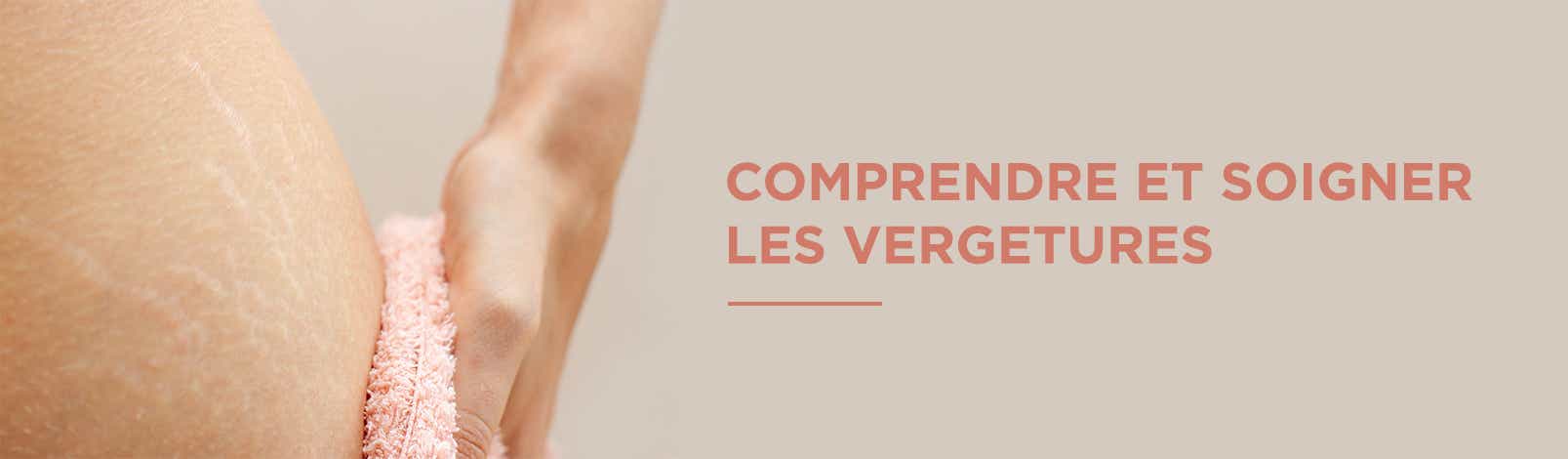 COMPRENDRE ET SOIGNER LES VERGETURES