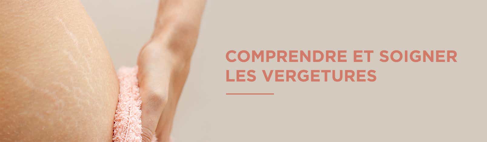 Comprendre et soigner les vergetures - Parapharmacie Boticinal