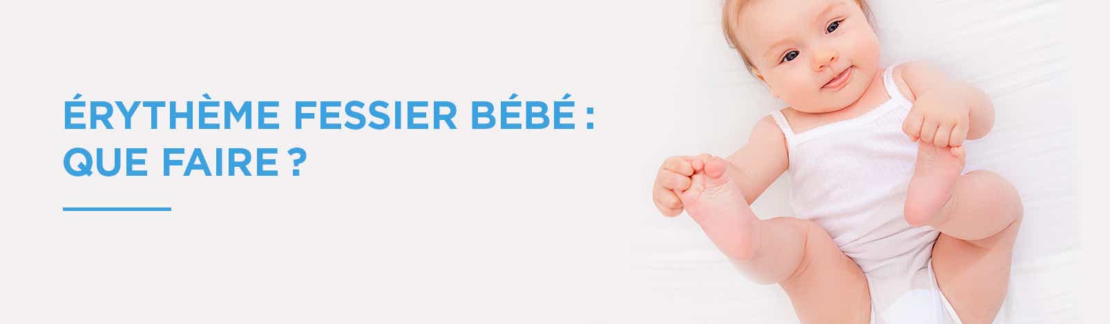 ÉRYTHÈME FESSIER BÉBÉ : CAUSE, TRAITEMENT ET PRÉVENTION